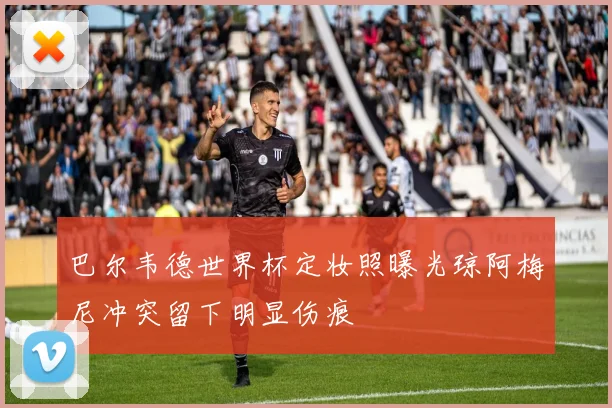 巴尔韦德世界杯定妆照曝光琼阿梅尼冲突留下明显伤痕